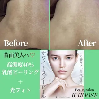 ICHOOSE/ 代々木上原/島田のエステ・リラクイメージ