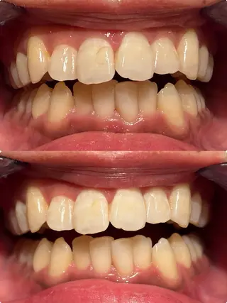 écrusmile ホワイトニングサロンのその他イメージ