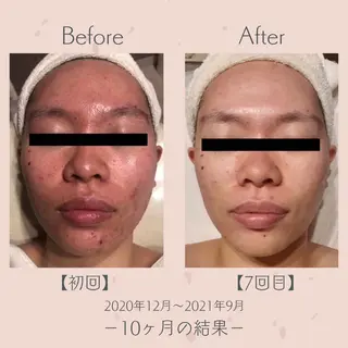 エステ＆美肌脱毛 ココサロ倉敷店のエステ・リラクイメージ