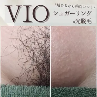 emirai💫 AYAのエステ・リラクイメージ
