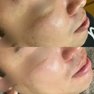 磐田|LAYLA 一番丁寧な脱毛店のエステ・リラクイメージ