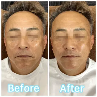 Beauty sal on Ren⭐️立谷のエステ・リラクイメージ