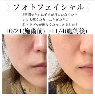 salon peacockのマツエク・マツパデザイン