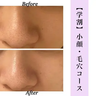 Bellesthe (ベルエステ)のエステ・リラクイメージ