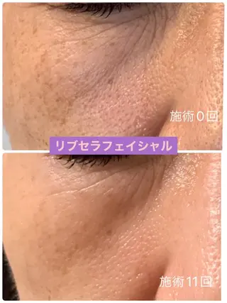 プライベートサロン プリュネルのエステ・リラクイメージ