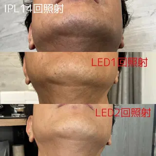 脱毛 yukinoのエステ・リラクイメージ