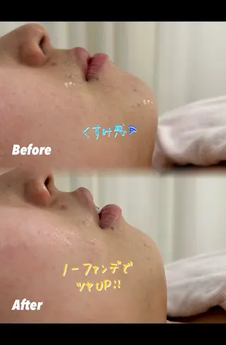 🫧美しい素肌へ🫧 今成柚乃のその他イメージ