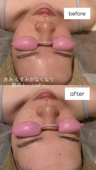 private salon Jのエステ・リラクイメージ