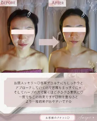 痩身ハーブピーリング 筋膜リリース☆B&Hのエステ・リラクイメージ