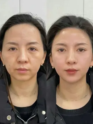 マツエク・マツパ 愛維美水光専門店 川崎彩鳳のエステ・リラクイメージ
