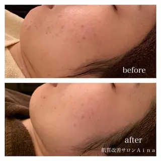 セミロング カラー パーマ ヘアアレンジ キッズ ネイル マツエク・マツパ ニキビ跡専門サロン Ainaのエステ・リラクイメージ