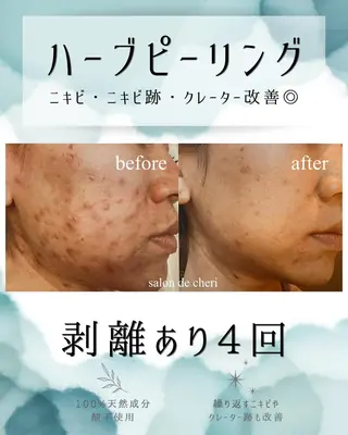 医療提携 肌管理痩身エステ池袋のエステ・リラクイメージ