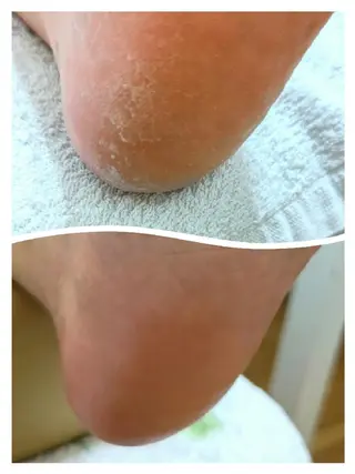 ネイル あんきち のネイルデザイン