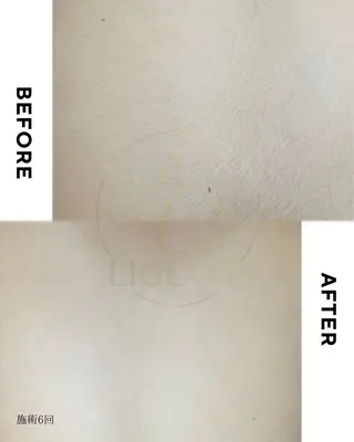 シミケア専門サロン LICCO’S岡崎のエステ・リラクイメージ