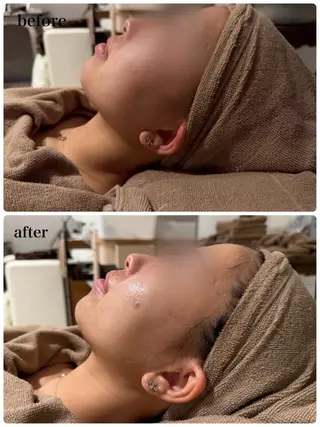 伊賀 穂奈美のエステ・リラクイメージ