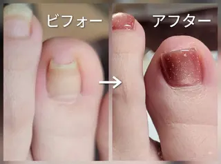 ネイル&巻き爪サロン AKnailのネイルデザイン