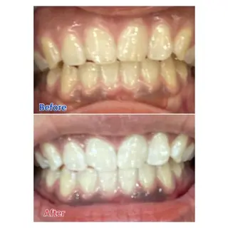 M渋谷 セルフホワイトニングのエステ・リラクイメージ