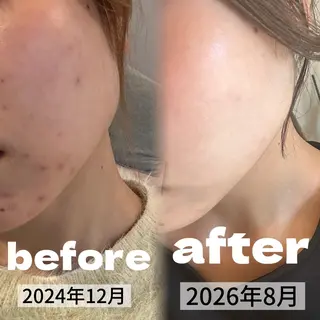 浮腫|肩こり|張り 日々の疲れを解消★のエステ・リラクイメージ