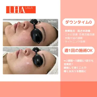 LiAm《韓国管理/ 小顔/脂肪ケア》のエステ・リラクイメージ