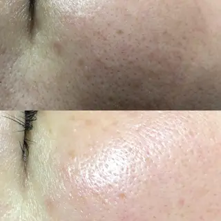 eyes アイズのマツエク・マツパデザイン