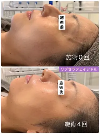 プライベートサロン プリュネルのエステ・リラクイメージ