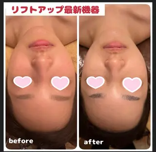 痩身Salon Charmeのエステ・リラクイメージ