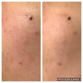 ミディアム カラー パーマ ヘアアレンジ キッズ ネイル マツエク・マツパ EnsorClair 代表 野口真央のエステ・リラクイメージ