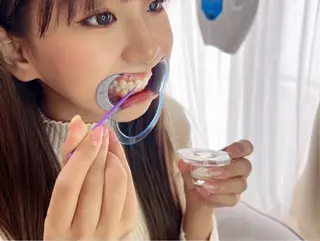 東区香椎歯のセルフホ ワイトニングGLOWのその他イメージ