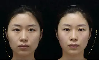 ネイル 愛維美水光専門店 川崎彩鳳のエステ・リラクイメージ