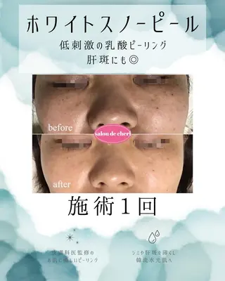 医療提携 肌管理痩身エステ池袋のエステ・リラクイメージ