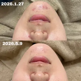 肌質改善専門サロン Lusisのエステ・リラクイメージ