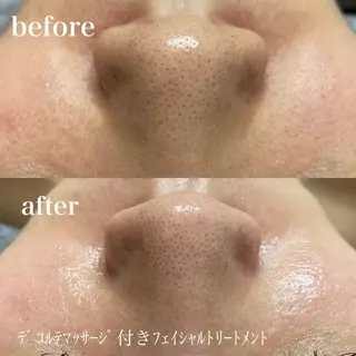 磐田|LAYLA 一番丁寧な脱毛店のエステ・リラクイメージ
