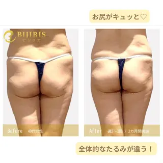 セルフ脱毛/美尻イス キングスサロン熊本のエステ・リラクイメージ