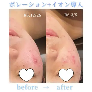 【Folche 春日店】馬場・大内田のエステ・リラクイメージ