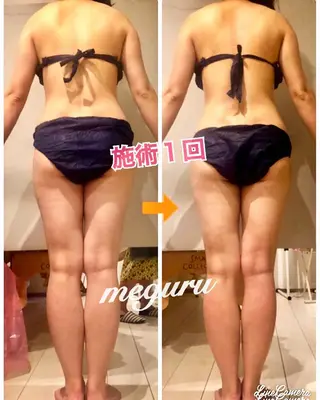 ショート カラー パーマ ヘアアレンジ メンズ キッズ ネイル マツエク・マツパ ‍痩身＆ボディ 結果出し🌟丹野のエステ・リラクイメージ