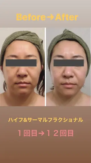 痩身・小顔・脱毛 グレイスボディのエステ・リラクイメージ