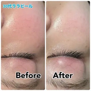 【毛穴・美白・美肌】 美・up 青葉台店のエステ・リラクイメージ