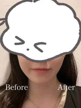【Beauel】 ここあのエステ・リラクイメージ