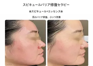 温活痩身美肌エステ サロンkiraraのエステ・リラクイメージ