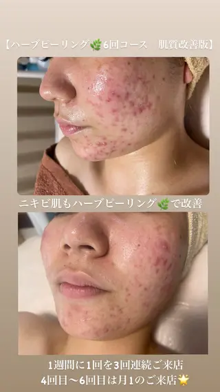 エステ プルメリアのエステ・リラクイメージ