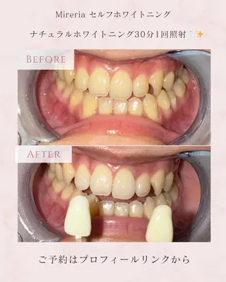 セルフホワイトニング &パーソナルカラーのその他イメージ