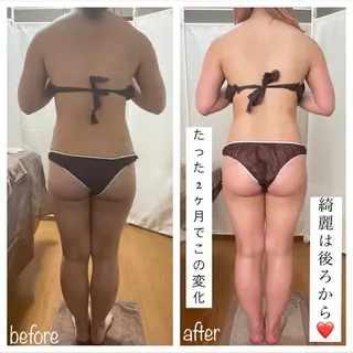 《本気痩せ×疲労改善 》  BILOOPのエステ・リラクイメージ