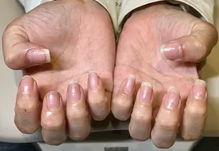 ネイル Neolive_ RINKAのネイルデザイン