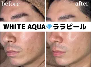 WHITE AQUA 🌼柏店のエステ・リラクイメージ