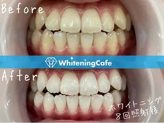 ホワイトニングカフェ 荻窪店のその他イメージ