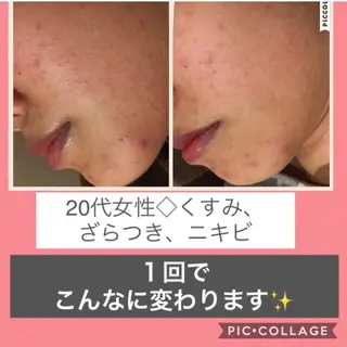 ミディアム カラー パーマ ヘアアレンジ メンズ キッズ ネイル マツエク・マツパ ニキビ・肌質改善専門 ♡人生が変わるサロンのエステ・リラクイメージ
