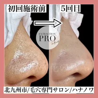 毛穴&リンパマッサー ジ専門サロン花のWAのエステ・リラクイメージ