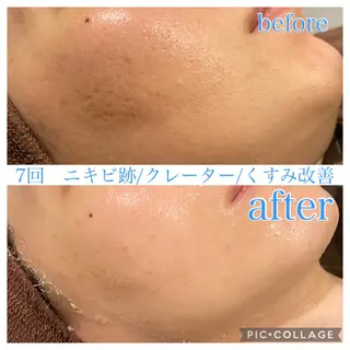 セミロング カラー パーマ ヘアアレンジ メンズ ネイル マツエク・マツパ EnsorClair 代表 野口真央のエステ・リラクイメージ