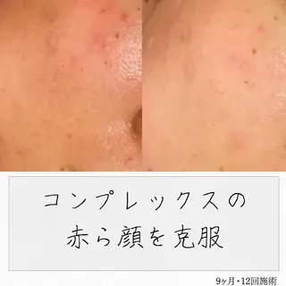 ニキビ経験者が施術 する専門サロン🌻のエステ・リラクイメージ
