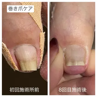 ネイル ダンラップ新里 友簣乃のネイルデザイン